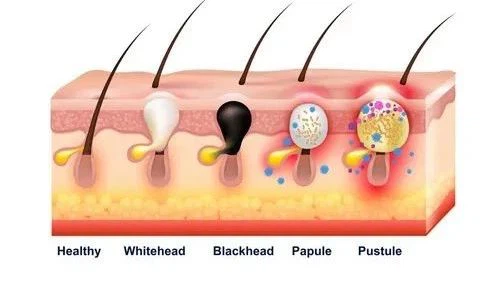 Pharmacokinetics Pharmacokinetics